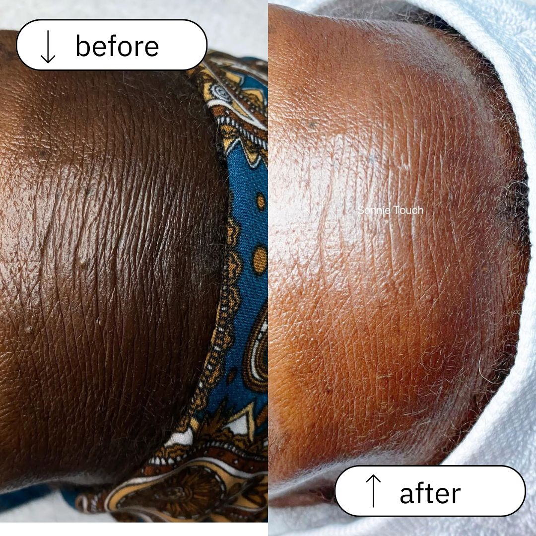 Anti Aging before and after (1)
