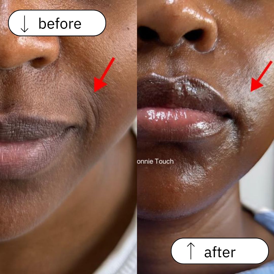 Anti Aging before and after